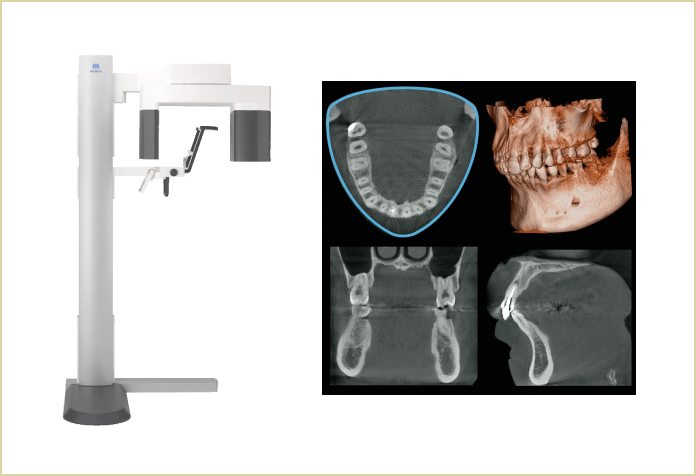 歯科用CT